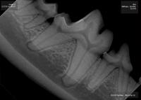 Radiograph of healthy teeth
